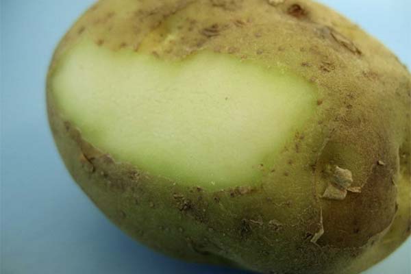 Signes d'intoxication par les pommes de terre vertes chez l'homme