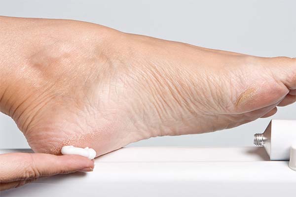 Soins des talons fissurés